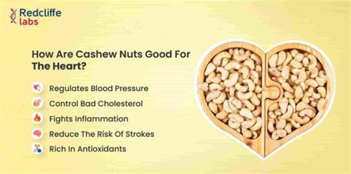 Are cashews good for brain?